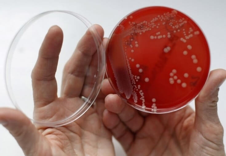 Бактериальный вагиноз: современные данные относительно причин заболевания