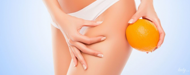 Целлюлит: почему появляется и как предотвратить его появление