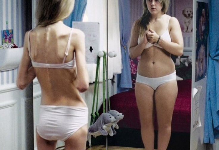Диетолог Ольга Копылова: сильное похудение опасно для организма