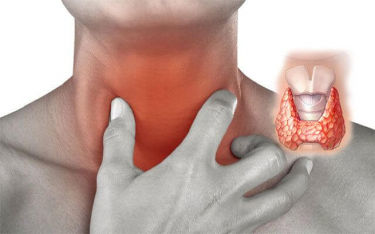 Гиперфункция щитовидной железы: мониторинг назначения препаратов