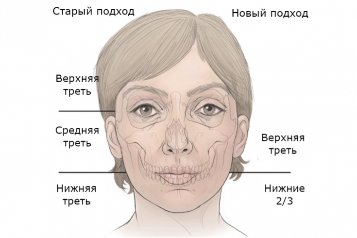 Импланты для коррекции средней трети лица – устаревшая методика