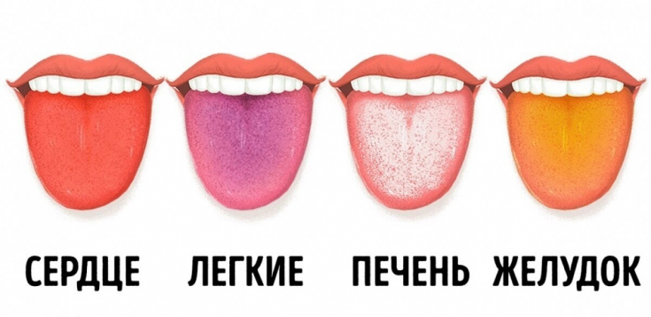 Как определить болезнь по цвету языка