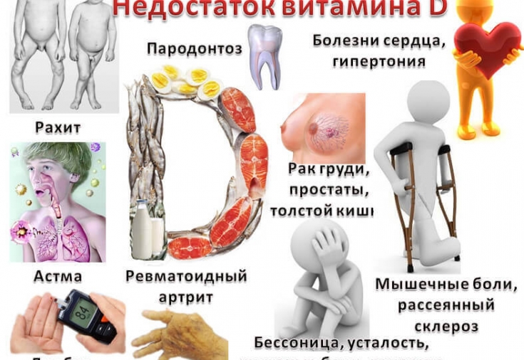 Как определить, что Вам не хватает витамина D