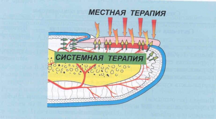 Лечение грибка изнутри: системная терапия онихомикоза