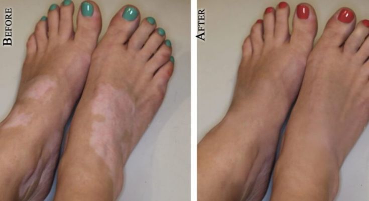 Медицинская татуировка: когда есть, что скрывать