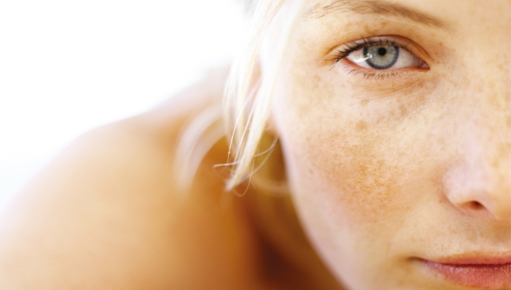 Невероятные возможности нутрикосметики: профилактика и лечение гиперпигментации