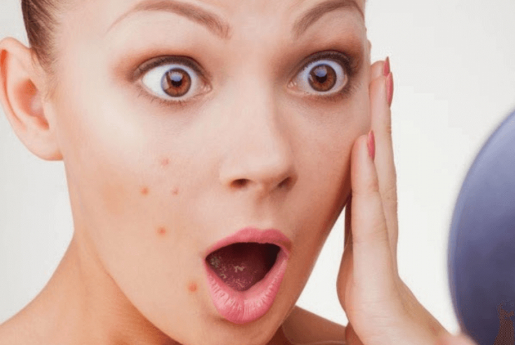 Красота при любых условиях: уход за кожей при атопическом дерматите на лице