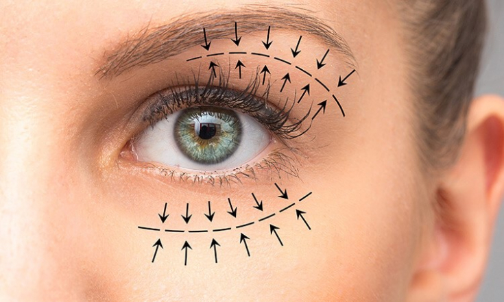 Пластика век: преимущества, особенности и показания