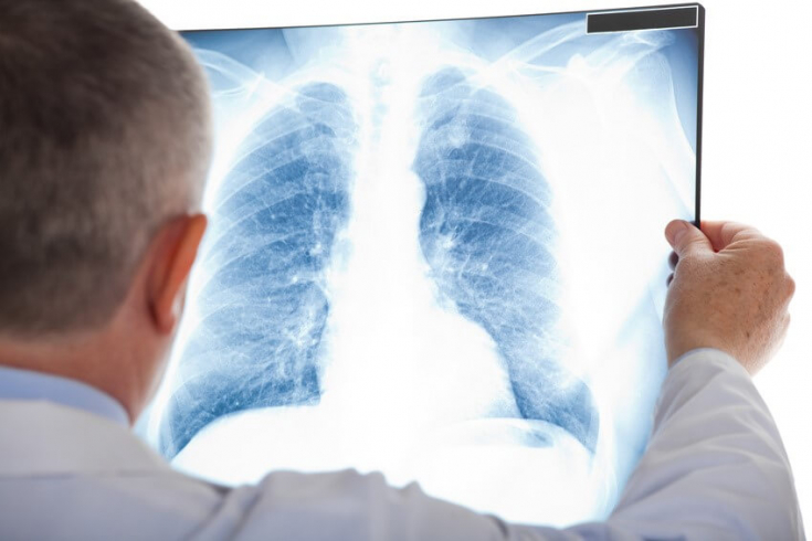 Подходы к лечению инфекционных заболеваний нижних дыхательных путей