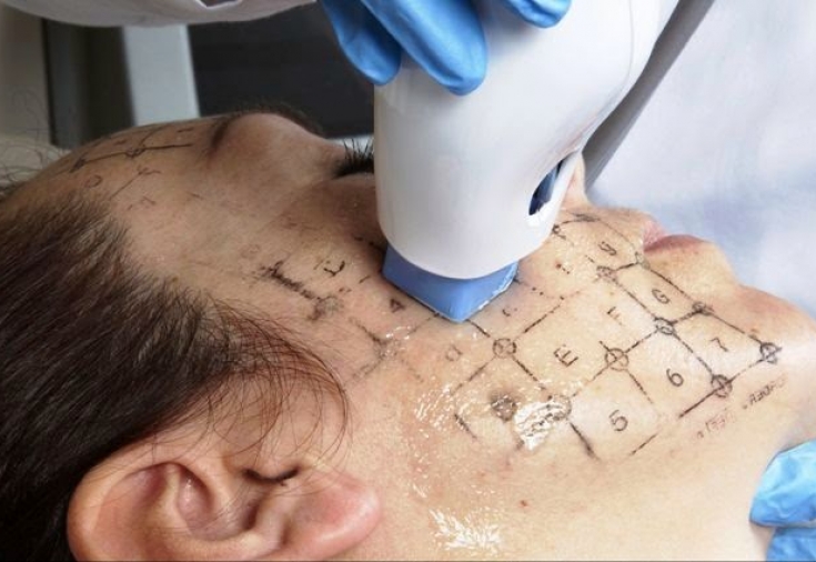 Прибор Thermage: причины негодования и их устранение