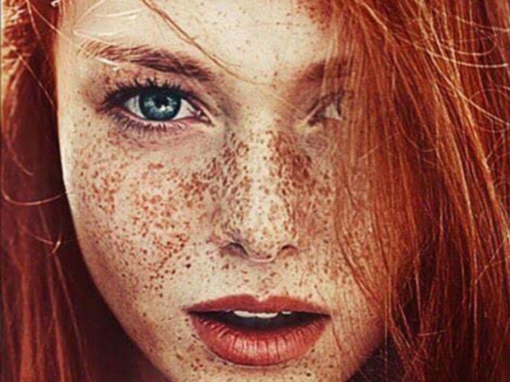 Причины гиперпигментации и современные способы ее устранения