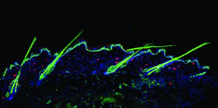Причины облысения: ученые обнаружили новые аспекты на клеточном уровне