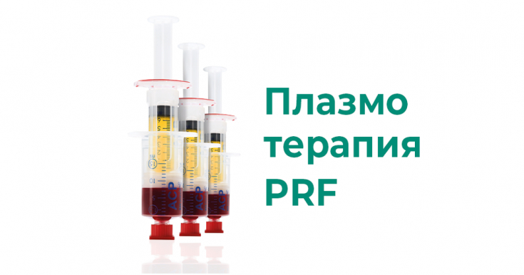 Регенерация кожи без побочных эффектов: плазмотерапия PRF в косметологии