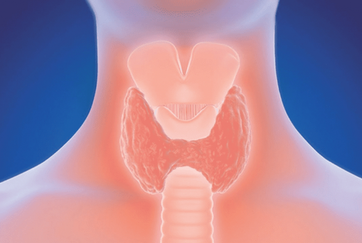 Скрытое воспаление: как быстро диагностировать зоб щитовидной железы