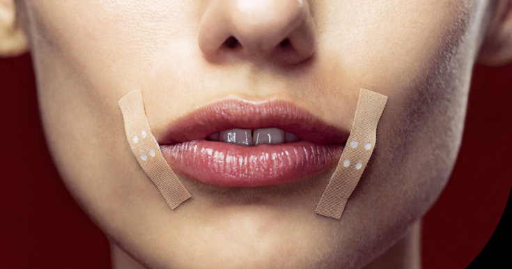 Трещины в уголках губ: почему появляются и как лечить
