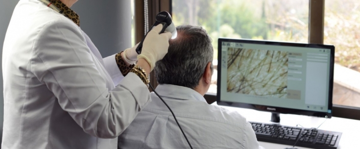 Трихоскопия: эффективный метод диагностики алопеции