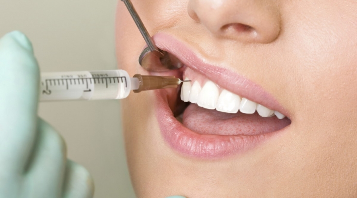 Возможные осложнения после имплантации зубов и их предупреждение