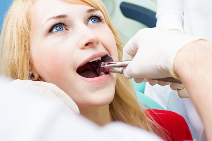 Заживление после удаления зуба: что нужно знать