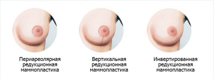 My default image
