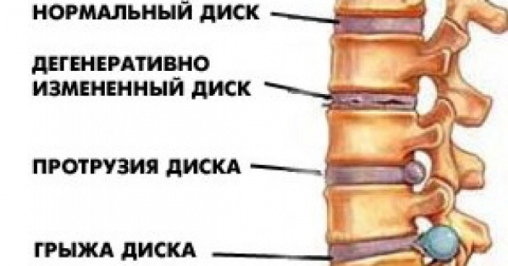 My default image
