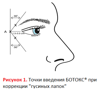 My default image