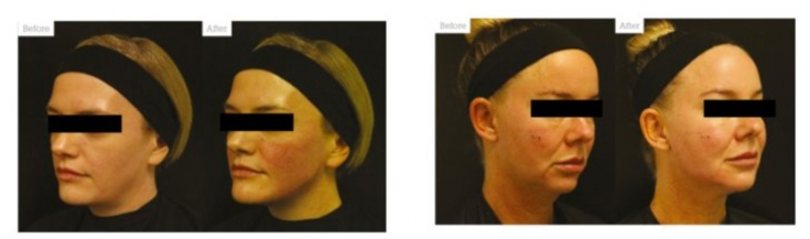 My default image