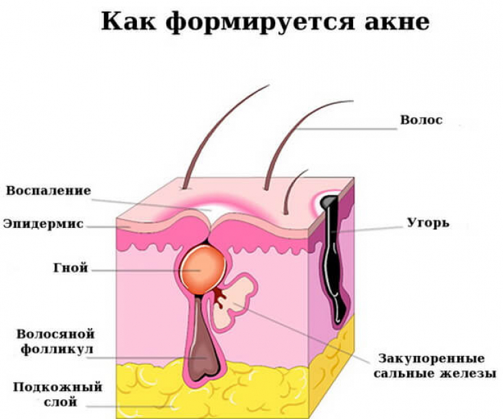 My default image