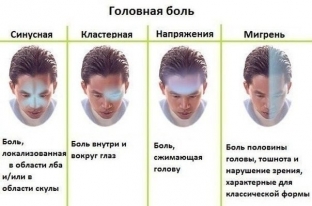 10-proverennyh-sposobov-kotorye-izbavyat-ot-golovnoj-boli- takzhe-ot-boli-v-spine-i-sustavakh