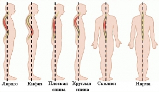 3-argumenta-kotorye-zastavyat-vas-vypryamit-spinu-pryamo- sejchas