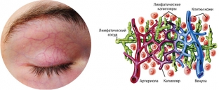  5-voprosov-kotorye-vy-khoteli-by-zadat-pro-preparat-mesoeye-s71