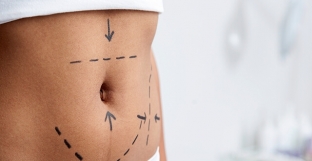 abdominoplastika-i-liposaktsiya-idealnaya-figura-bystro-i-navsegda
