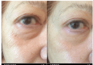 anti-age-terapiya-iddna-skin-care-sekret -molodosti-kozhi-v-vashikh-genakh