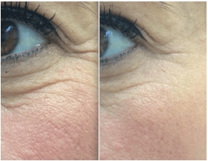 anti-age-terapiya-iddna-skin-care-sekret-molodosti -kozhi-v-vashikh-genakh