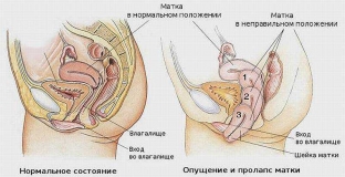 chto-proiskhodit-s-organizmom-zhenshchiny-v-periode- postmenopauzy