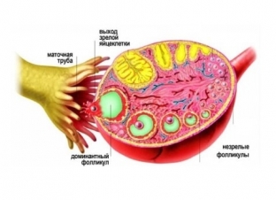 kak-diagnostirovat-i-vylechit-nadpochechnikovuyu-giperandrogeniyu-u></p>
<h2>Лікувальна тактика при наднирниковій гіперандрогенії у жінок</h2>
<p>Лікувальна тактика при гіперандрогенії у жінок має кілька основних цілей:</p>
<ul>
<li>нормалізація менструального циклу та відновлення репродуктивної функції;</li>
<li>стимуляція овуляції та підтримання вагітності, щоб уникнути її невиношування;</li>
<li>усунення вірильних симптомів гіперандрогенії у жінок.</li>
</ul>
Для досягнення цих цілей пацієнткам проводиться корекція гормональних порушень глюкокортикостероїдними препаратами. Доза дексаметазону підбирається індивідуально відповідно до результатів лабораторних досліджень. Ефективність лікування контролюється шляхом проведення гормональних досліджень, спостереження за менструальним циклом та вимірювання базальної температури для визначення настання овуляції. При настанні вагітності її невиношування попереджають шляхом продовження глюкокортикоїдної терапії. Гормональні препарати, що містять естрогени та антиандрогени ефективні у боротьбі з гіпертрихозом та гнійниковими висипаннями на шкірі. Антиандрогенний ефект також дає верошпірон, внаслідок пригнічення утворення тестостерону та дигідротестостерону у шкірі пацієнтки.


                        

                        

                        <div id=