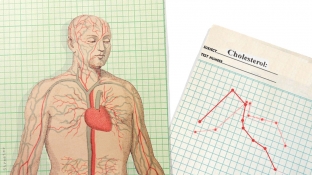 kak-kholesterin-vliyaetna kishechnika