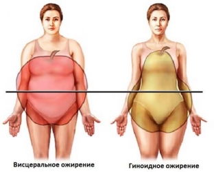 kak-menyaetsya-uroven-zhenskikh-gormonov-pri-ozhirenii