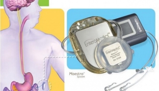 kak-pokhudet-s-pomos /></p>
<p>Безпека та ефективність такого пристрою вже були підтверджені після проведених експериментів, у яких взяли участь 233 добровольці, які мали проблеми із зайвою вагою. Однак планується проведення додаткових досліджень, які займуть ще п'ять років, і лише після цього зроблені висновки можуть бути підкріплені доказовою базою.</p>
<p>Джерело <a href=