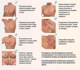 kak-provesti-samostoyatelnoe-obsledovanie-i-vyyavit-priznaki-mastopatii-molochno zhelezy