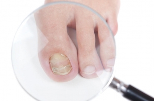 kakie-izmeneniya-nogtej-voznikayut-v-rezultate-vnutrennikh-zabolevanij