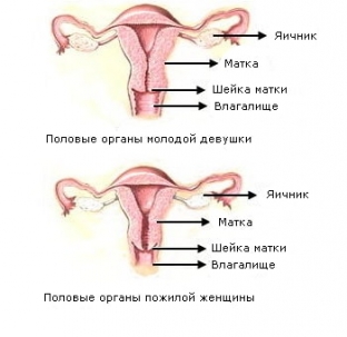kakie-izmeneniya-proiskhodyat-v-polovykh-organakh-zhenshchiny-posle-
                        ></p>
<p>Найбільш виражені атрофічні процеси у ньому під час перших 2-5 років після менопаузи. Ехогенність міометрію у перші роки після менопаузи середня, і зростає вона зі збільшенням тривалості постменопаузального періоду. Спостерігаються фіброзні зміни у міометрії у вигляді виникнення множинних гіперехогенних ділянок у ньому. За даними доплерівського дослідження реєструється значне збіднення кровотоку в периферичних шарах міометрію. У той же час, якщо у жінки до менопаузи спостерігалися міоматозні вузли, вони також зазнають інволюції після менопаузи.</p>
<h2>Характерні зміни ендометрію після менопаузи</h2>
<p>Ендометрій після менопаузи також піддається інволютивним процесам. Якщо до настання менопаузи ендометрій постійно зазнає циклічних змін під впливом репродуктивних гормонів, то після менопаузи він взагалі атрофується. За рахунок атрофії ендометрію значно зменшується поздовжній та поперечний розміри порожнини матки. При тривалому постменопаузальному періоді атрофія ендометрію може супроводжуватися формуванням синехій, які, за даними ультразвукового дослідження, реєструються як лінійні включення підвищеної ехоплотності. Після менопаузи відбувається значне звуження просвіту цервікального каналу, аж до його повного зарощення. Внаслідок цього в порожнині матки може спостерігатися скупчення невеликої кількості рідини, що не є патологією.</p>
<h2>Як зміни гормонального фону після менопаузи відбиваються на яєчниках</h2>
<p>Зміни гормонального фону після менопаузи відбиваються також на структурі самих яєчників. У постменопаузі значно зменшується їх обсяг та розміри, спостерігаються також зміни ехоструктури яєчників. Виділяють два основні типи постменопаузальних змін у яєчниках:</p>
<ul>
<li>при змінах атрофічного типу – спостерігається значно зменшення обсягу та розмірів яєчників;</li>
<li>при змінах гіперпластичного типу – розміри яєчників зменшуються поступово та досить повільно, можливе утворення дрібних рідинних включень до них.</li>
</ul>
<h2>Профілактична діагностика після менопаузи – найкращий спосіб захисту від хвороб</h2>
<p>На сьогоднішній день використання високоінформативних діагностичних методів дозволяє своєчасно виявляти та усувати будь-які патологічні процеси, що виникають у статевих органах жінки після менопаузи. Необхідно своєчасно та детально інформувати всіх жінок цієї вікової категорії про необхідність проведення таких досліджень. Максимально ефективним методом лікування клімактеричних проявів, що виникають після менопаузи, є призначення замісної гормональної терапії, можливі та досить рідкісні побічні ефекти якої можна попередити лише за допомогою грамотного індивідуального підбору терапевтичної схеми.</p>


                        

                        

                        <div id=