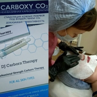 karboksiterapiya-carboxy-co2-dlya-litsa-i-shei-neinvazivnoe-reshenie problem