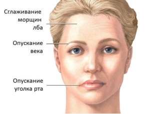 khit-parad-rasprostranennykh-oshibok-plasticheskikh-khirurgov