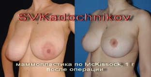krasivaya-grud-- -eto-sochetanie-khoroshej-formy-dostatochnogo-ob-ema-i-proportsionalnosti