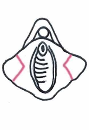 labioplastika-znachitelno-uluchshaet-seksualnuyu-zhizn-patsientok