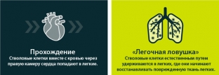 леченіе-заболеваніе-леґкіх-с-приміненням-стволових-клеток-патсіента