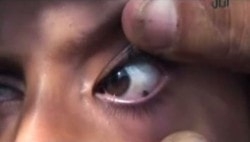 meditsinskie-zagadki-do-sikh-por-ne-podvlastnye-nauke