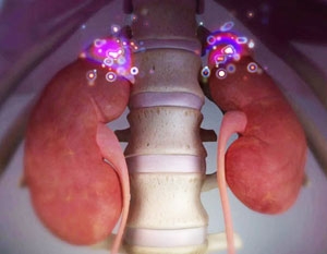 ob-yavlyaem-boj-gormon-stressa-kortizol-adrenalin- Чим більше виділяється кортизолу в організм, тим гірше почувається людина. Не просто руйнується м'язова тканина, яка є ідеальним матеріалом для кортизолу, а й руйнуються кістки. При постійних стресах та депресії людина починає шукати втіху в поїданні їжі, особливо солодкого та борошняного. Організм через постійне витрачання енергії дає позиви до збільшення апетиту, щоб відновити запаси. Зрештою, якщо надниркові залози постійно виділятимуть кортизон або інший гормон стресу, то просто відмовляться працювати і організм залишиться не захищений під час стресових ситуацій.</p>
<p>Інші причини підвищення рівня кортизолу в крові:</p>
<ul>
<li>захворювання сечостатевої системи, збої у злагодженій роботі репродуктивної функції;</li>
<li>порушення роботи щитовидної залози;</li>
<li>прийом стероїдних препаратів;</li>
<li>алкоголізм;</li>
<li>прийом наркотиків.</li>
</ul>
<p><img style=