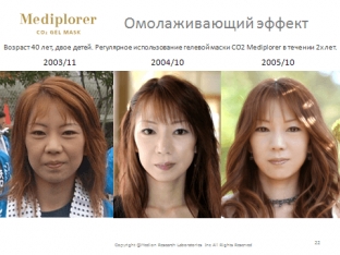 omolazhivayushchij-effekt-neinvazivnoj-karboksiterapii-mediplor>
<blockquote>
<p>Для посилення ефекту омолодження даної гелевої маски рекомендується застосовувати її в комплексі з іншими препаратами серії ЄС MEDIPLORER.</p>
</blockquote>
<div class=