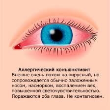 osnovnye-formy-i-simptomy-allergichesko-kon-yunktivita